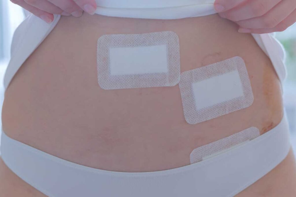 Cirugía de hernia con robot Da Vinci explicada por el Dr. José Rivas Becerra