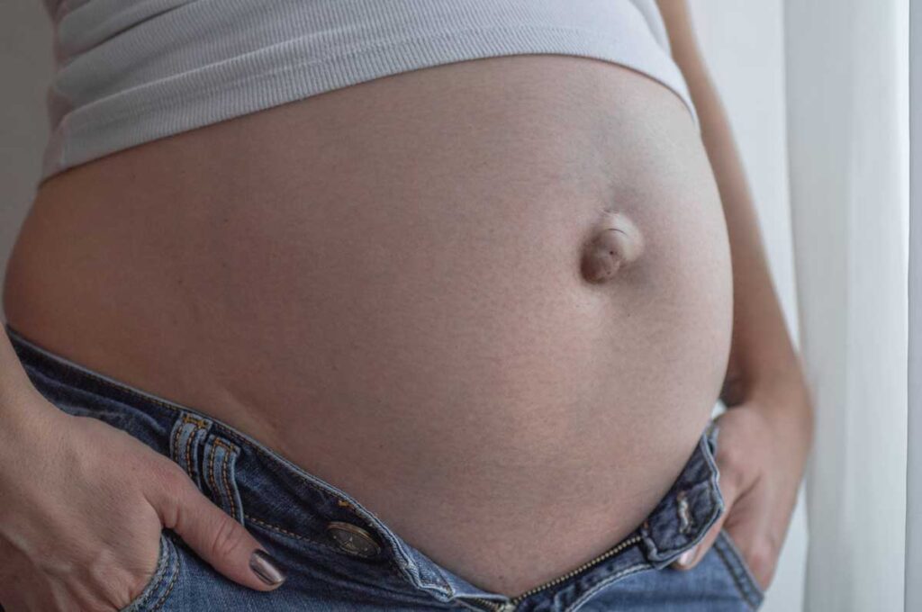 hernia umbilical en el embarazo – bulto en el ombligo durante la gestación – Dr. Rivas Becerra Hernia Center
